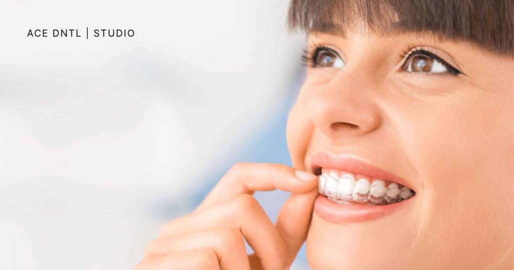 Can You Eat With Invisalign