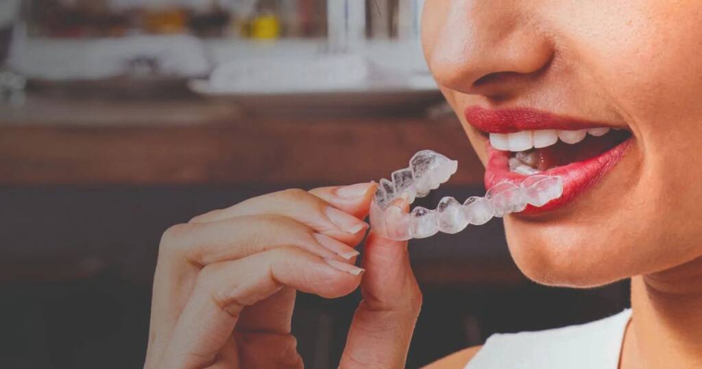 Drinks with Invisalign