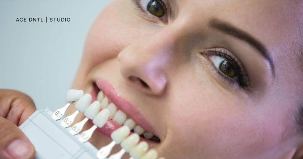 Removing Soda Stains from Teeth