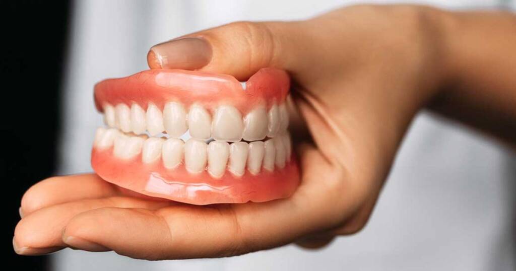 How Long Do Implant Overdentures Last