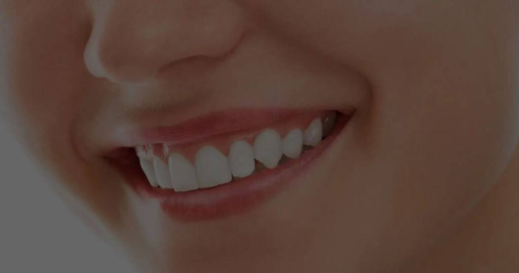 Dental Implants for Overdentures