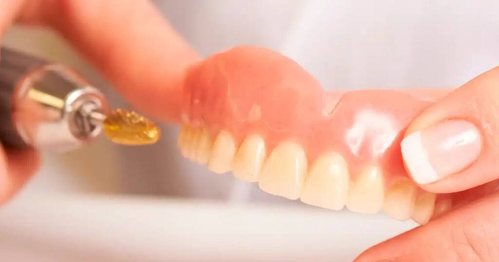Oral Health Benefits of Implant Overdentures