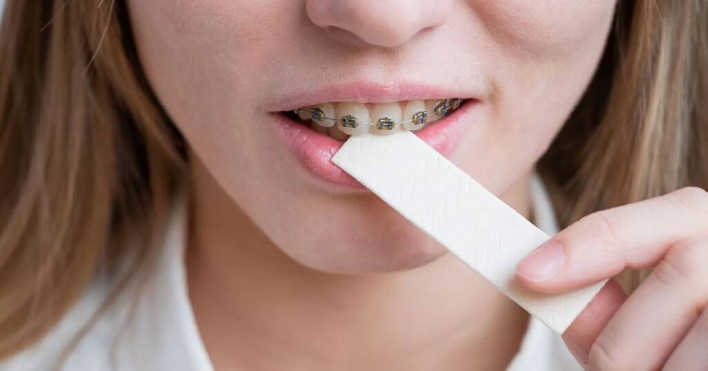 Sugar Free Chewing Gum with Braces and Dentures