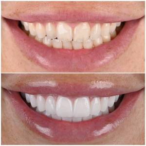 Marbella Dentist Smile 1