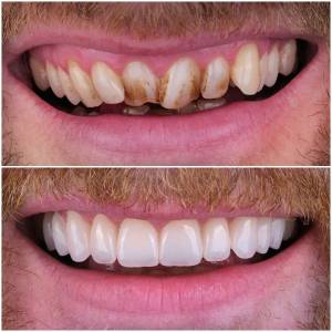 Marbella Dentist Smile2