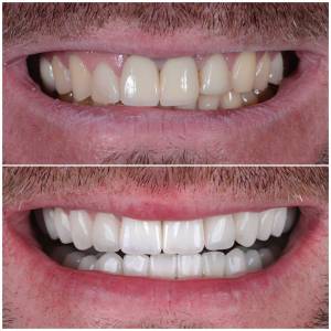 Marbella Dentist Smile3