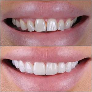 Marbella Dentist Smile4