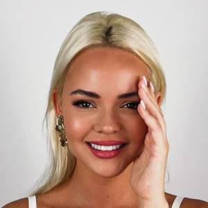 Marbella Dentist Smile8