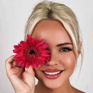 Marbella Dentist Smile9