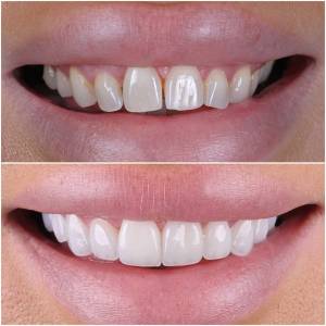 Marbella Dentist Smile 9