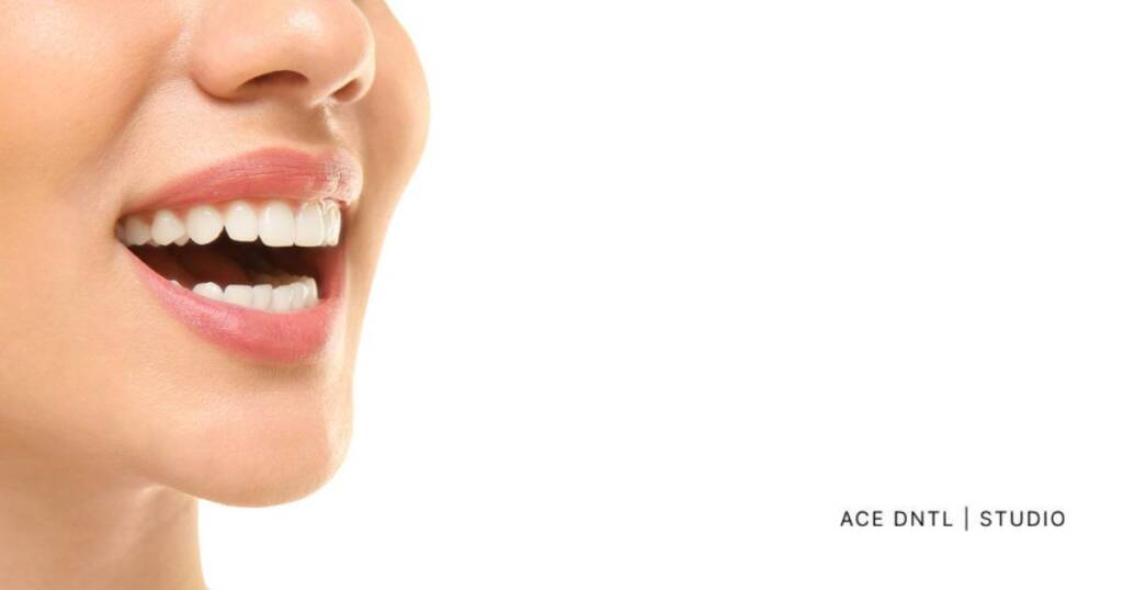 does whitening toothpaste work