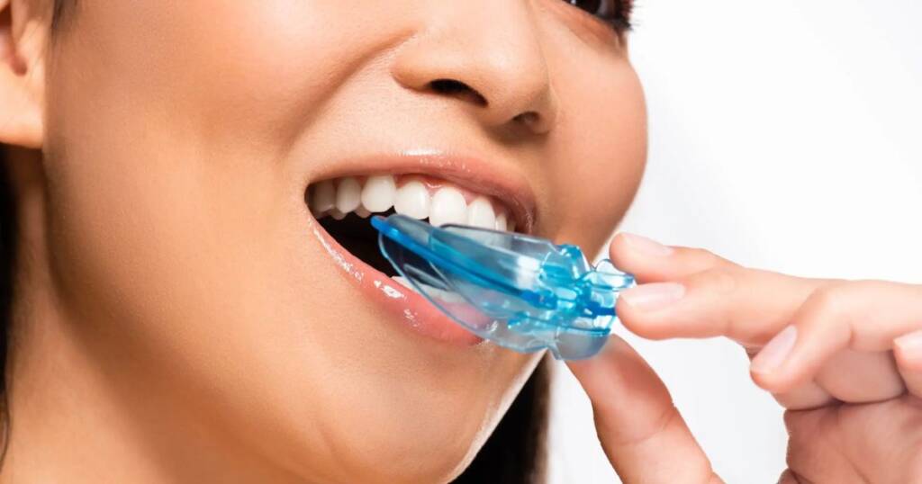 Night Guard for Teeth