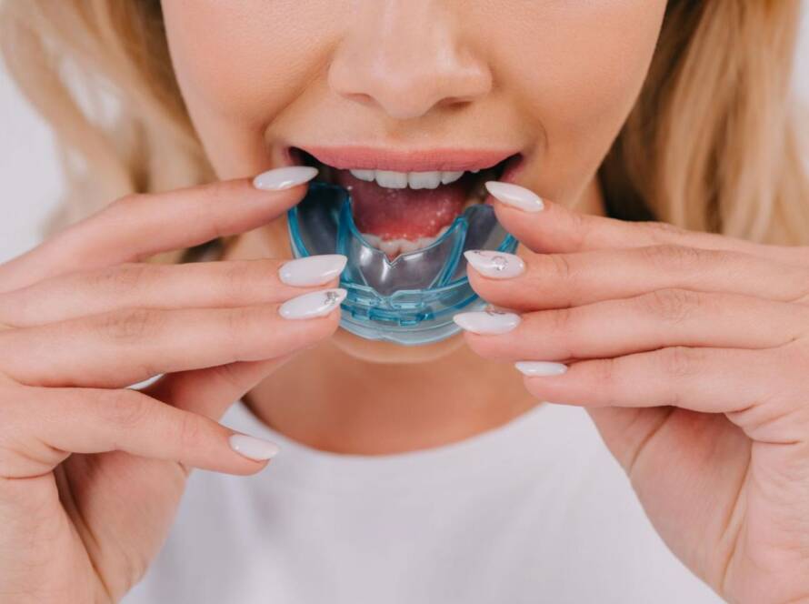 Night Guard for Teeth