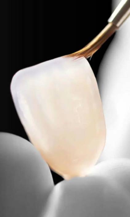 General dentist Marbella