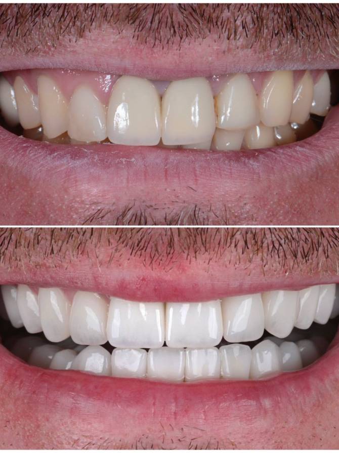 Marbella Dentist Smile3